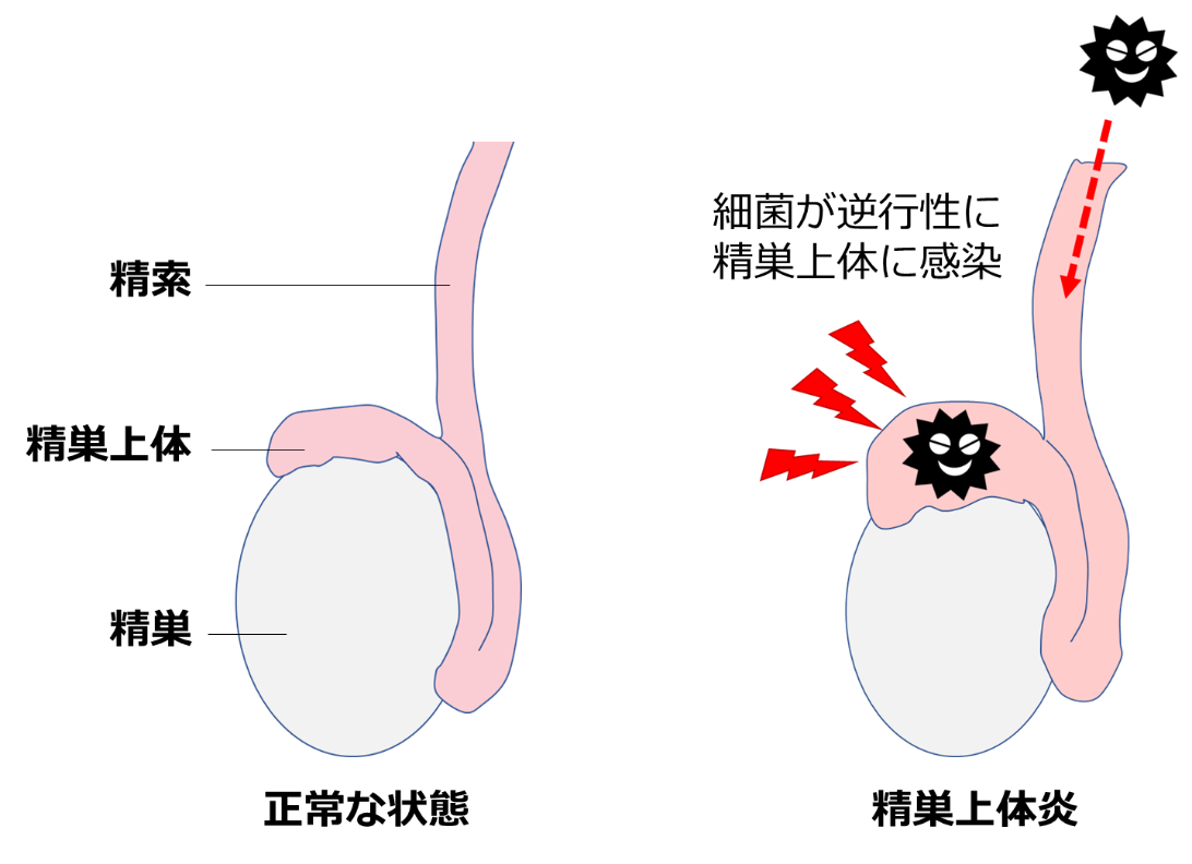 精巣の病気 | 志田泌尿器クリニック